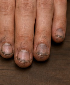 Nails - avoid