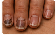 Unkempt Nails - avoid