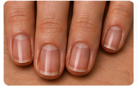Unkempt Nails - better